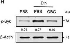 Detection of Mouse Mouse Dectin-1/CLEC7A Antibody by Western Blot