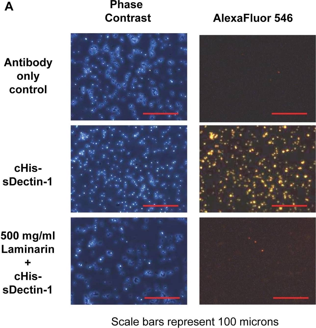 Detection of Yeast Dectin-1/CLEC7A by Immunocytochemistry/Immunofluorescence
