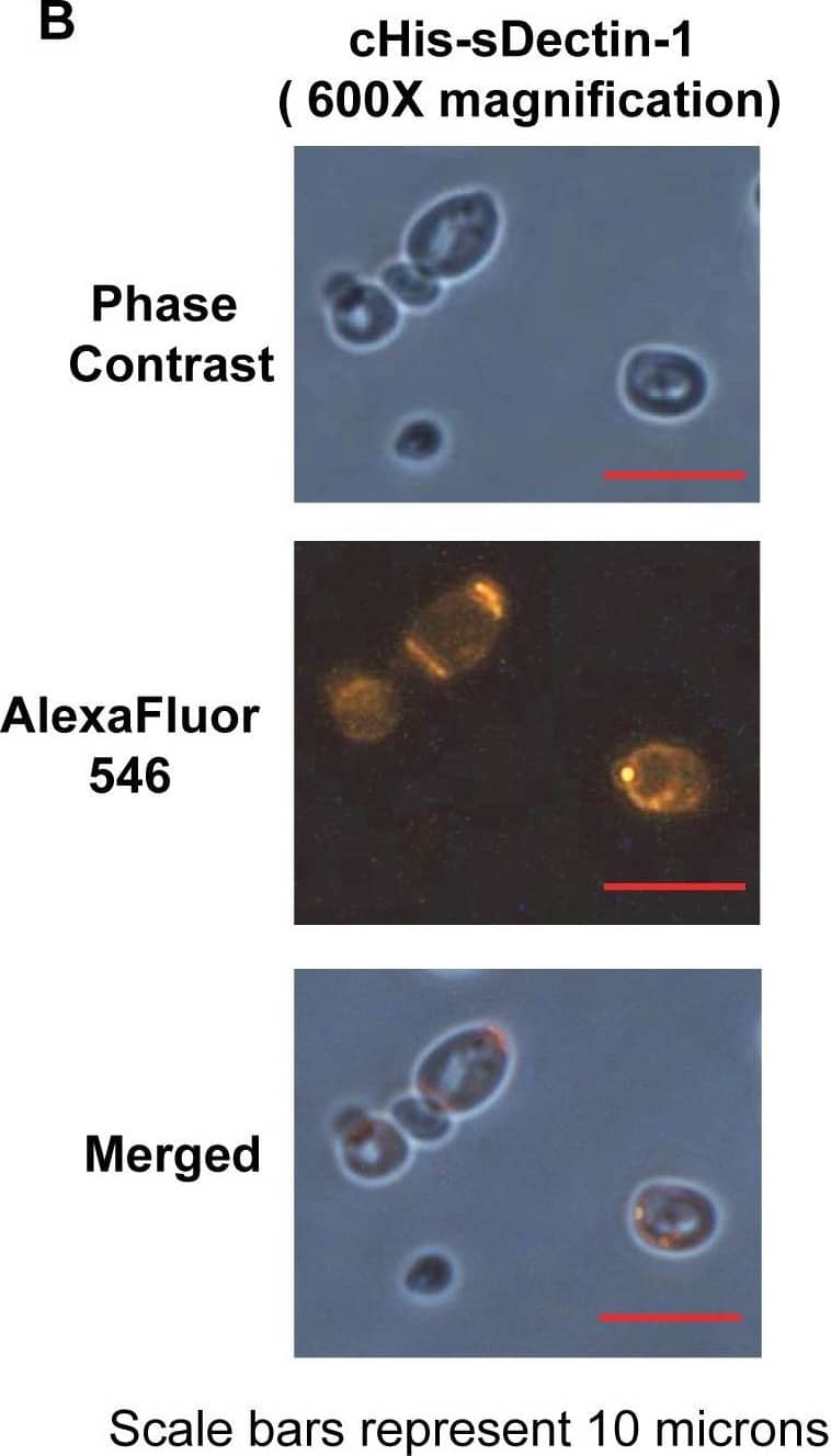 Detection of Yeast Dectin-1/CLEC7A by Immunocytochemistry/Immunofluorescence