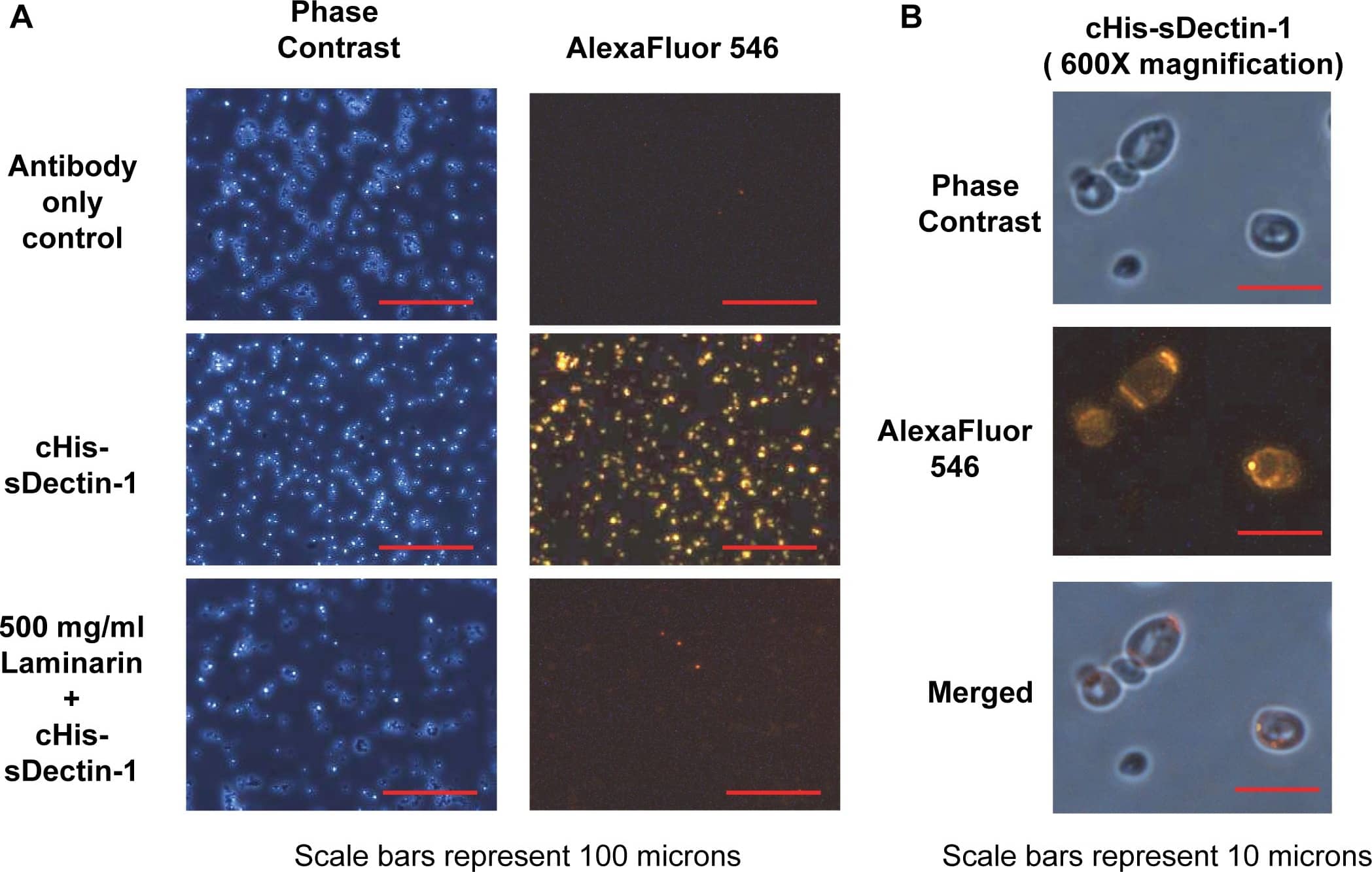 Detection of Yeast Dectin-1/CLEC7A by Immunocytochemistry/Immunofluorescence
