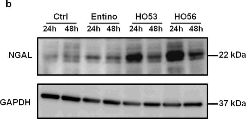 Detection of Human Lipocalin-2/NGAL by Western Blot