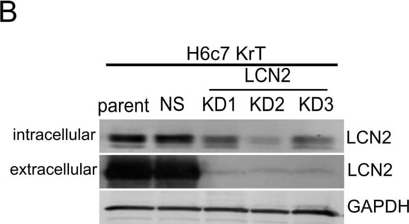 Detection of Lipocalin-2/NGAL by Western Blot