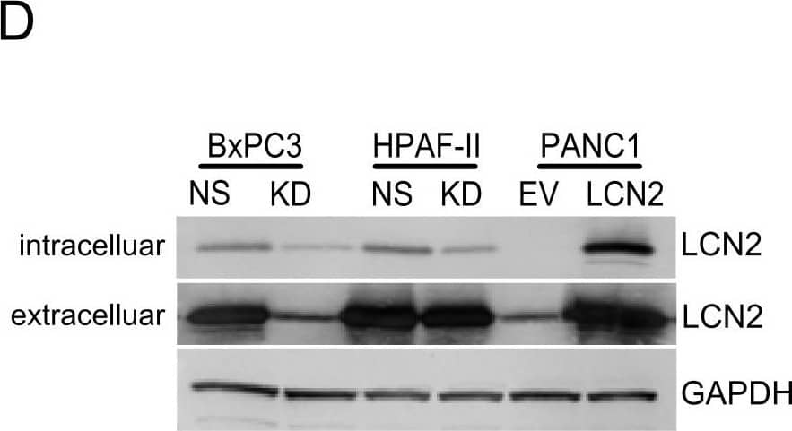 Detection of Lipocalin-2/NGAL by Western Blot
