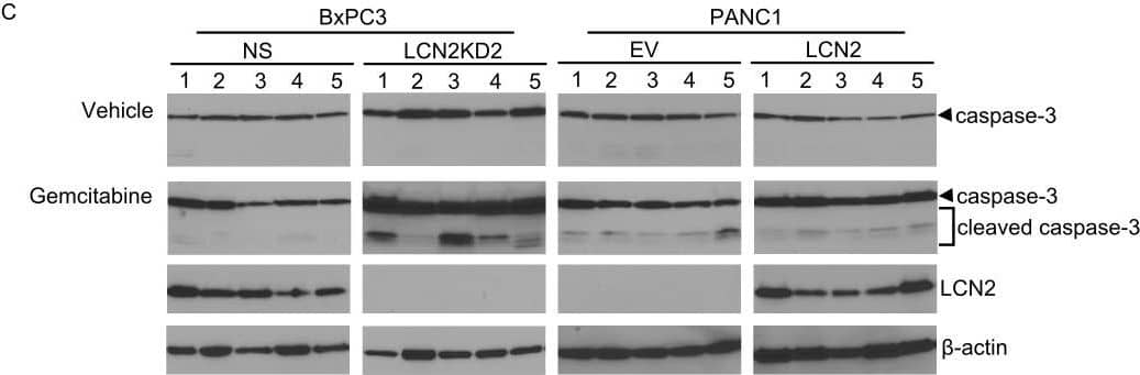 Detection of Lipocalin-2/NGAL by Western Blot