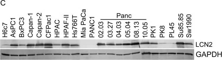 Detection of Lipocalin-2/NGAL by Western Blot