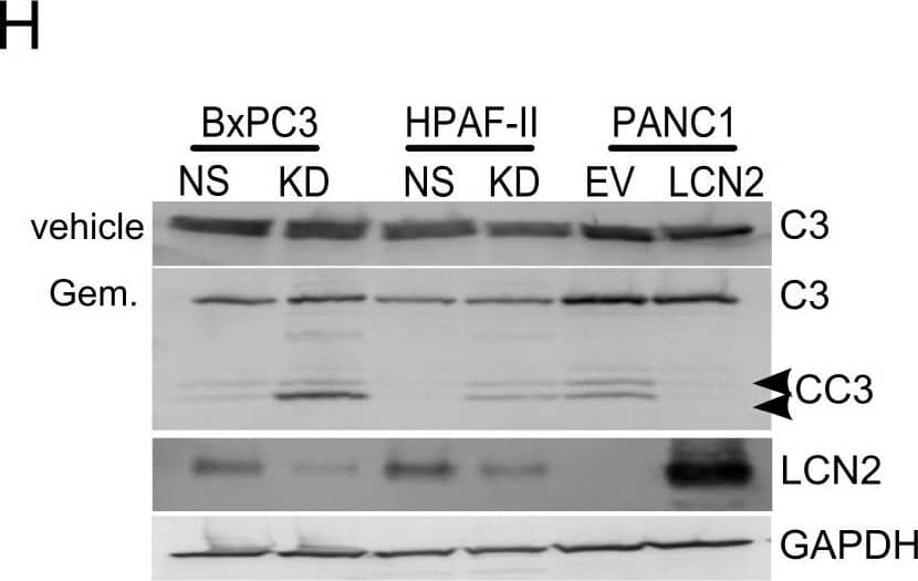 Detection of Lipocalin-2/NGAL by Western Blot