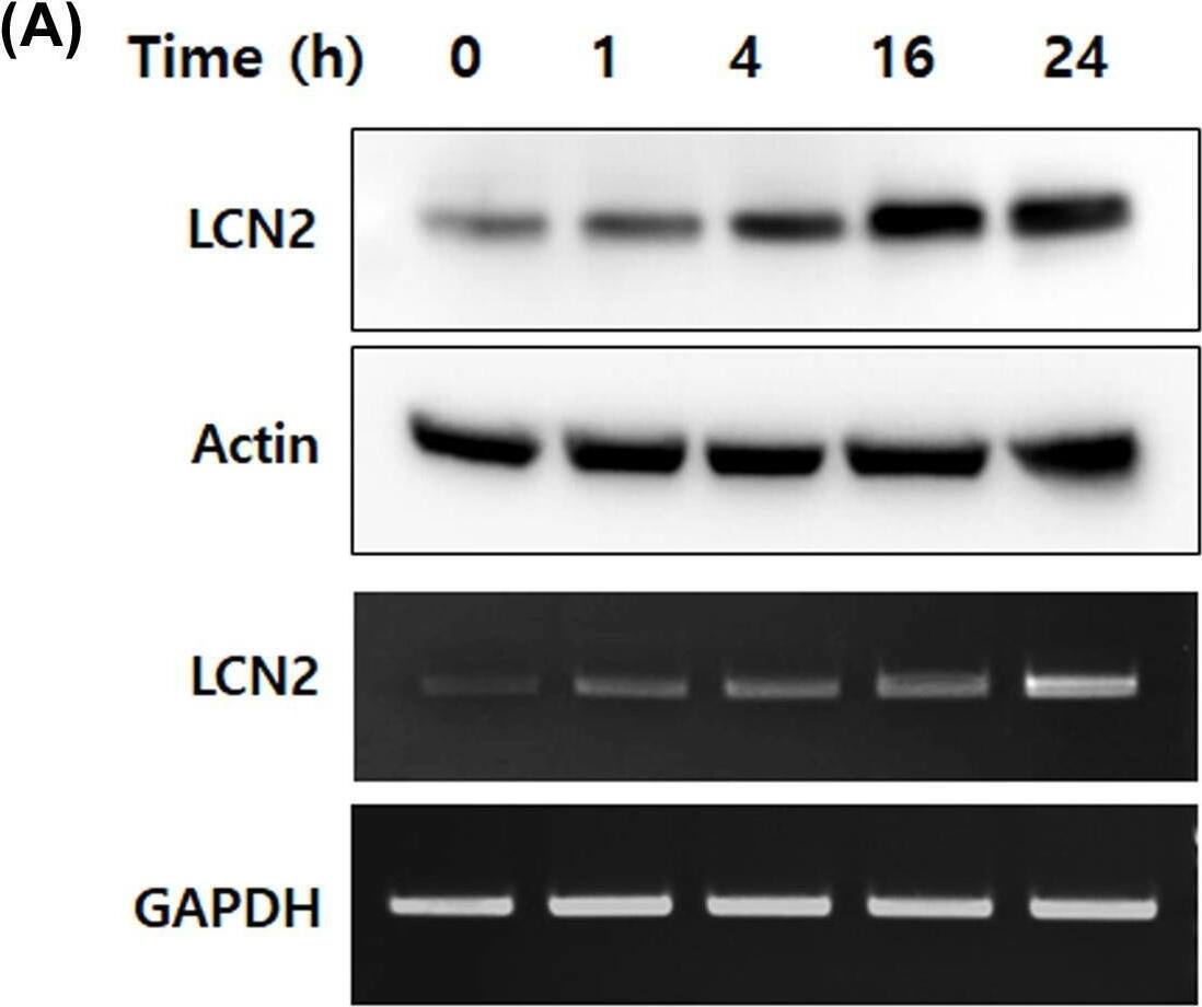 Detection of Lipocalin-2/NGAL by Western Blot