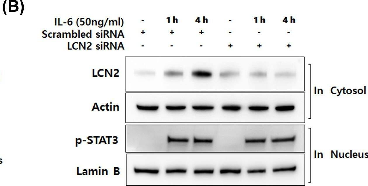 Detection of Lipocalin-2/NGAL by Western Blot
