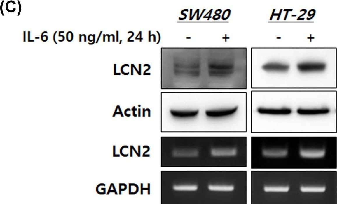 Detection of Lipocalin-2/NGAL by Western Blot