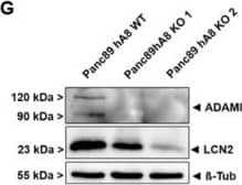 Detection of Human Lipocalin-2/NGAL by Western Blot