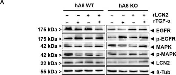Detection of Human Lipocalin-2/NGAL by Western Blot