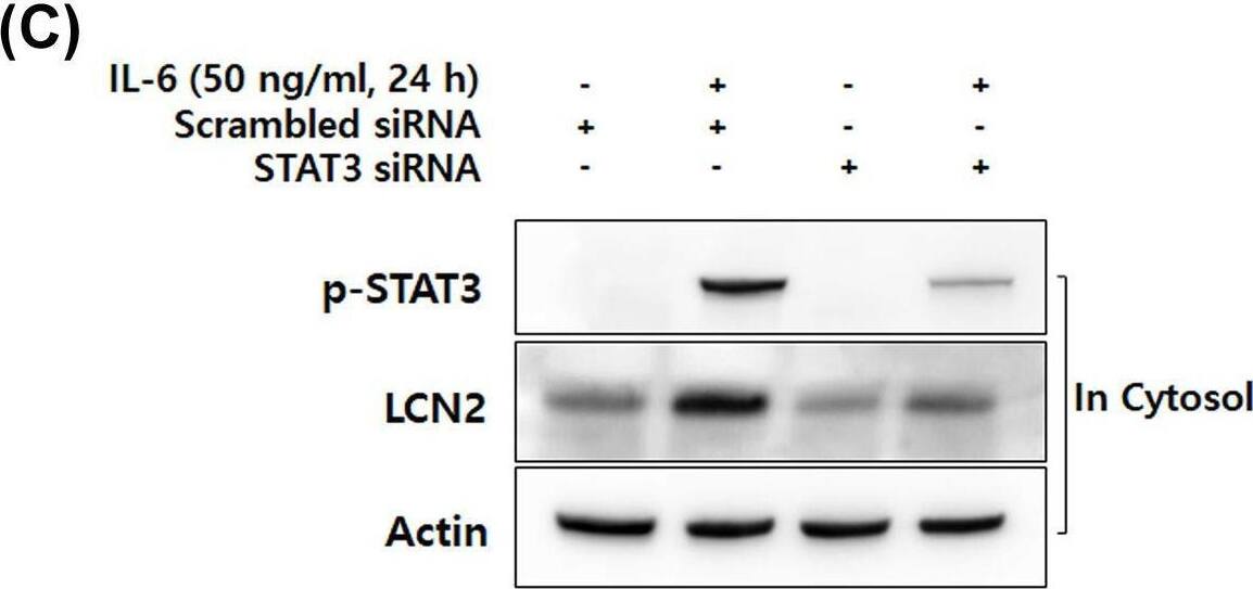 Detection of Lipocalin-2/NGAL by Western Blot