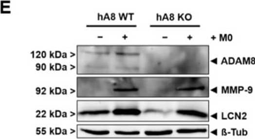 Detection of Human Lipocalin-2/NGAL by Western Blot