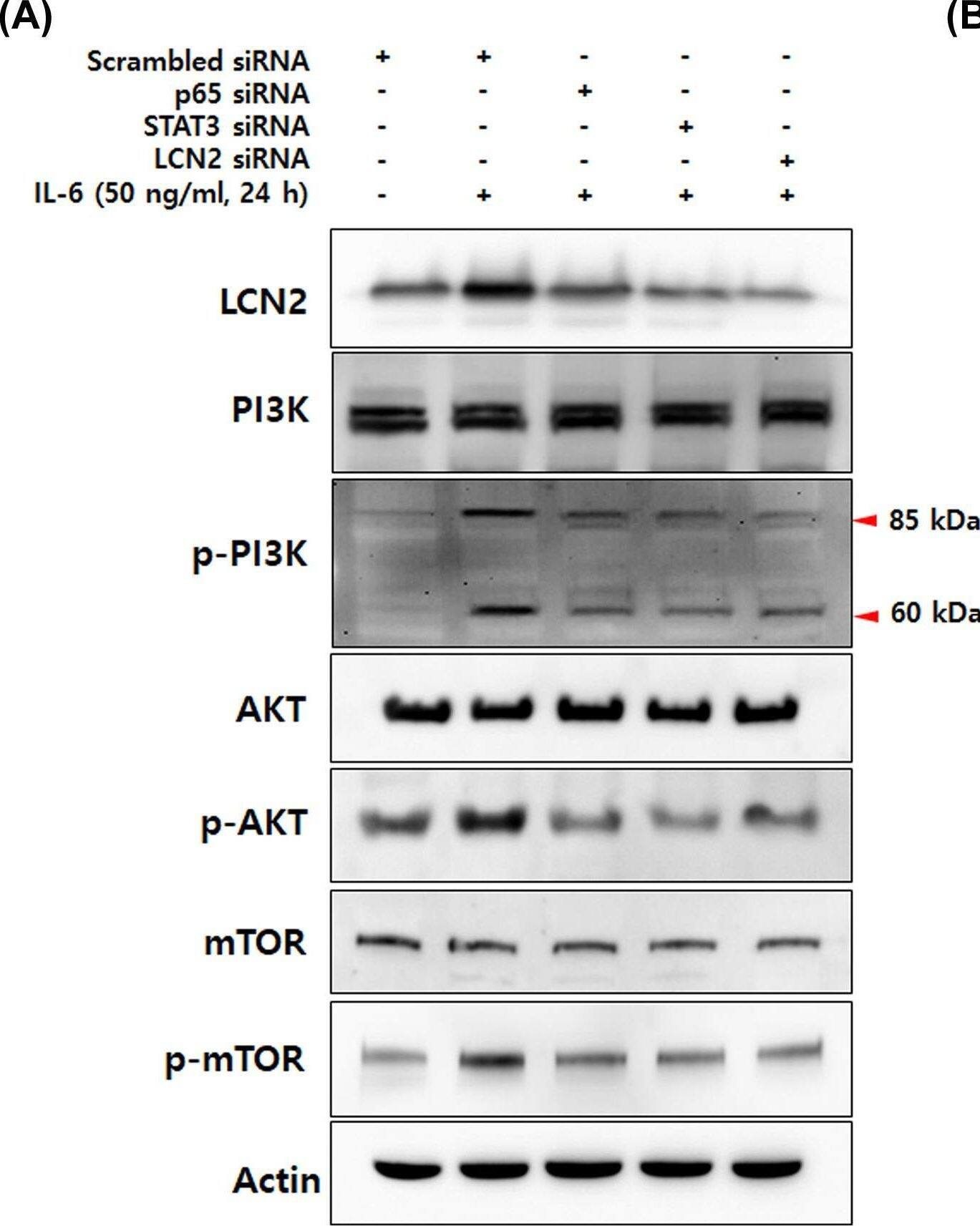Detection of Lipocalin-2/NGAL by Western Blot
