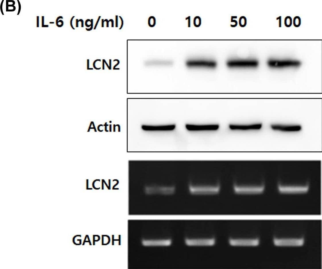 Detection of Lipocalin-2/NGAL by Western Blot