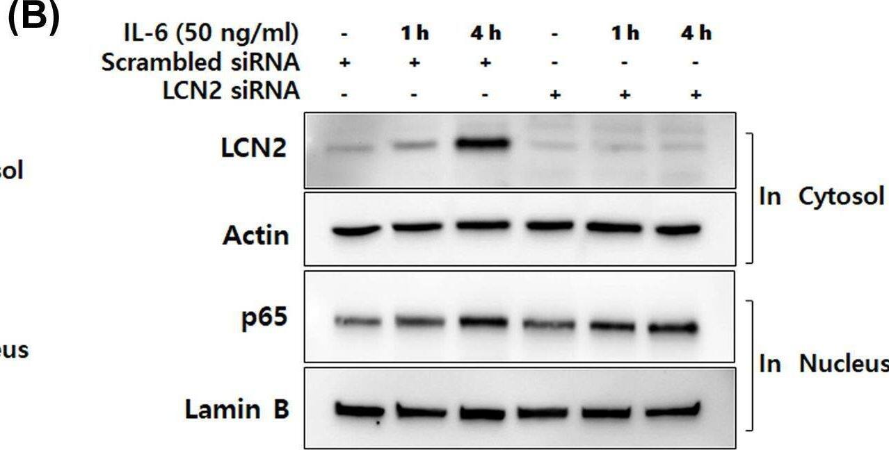Detection of Lipocalin-2/NGAL by Western Blot