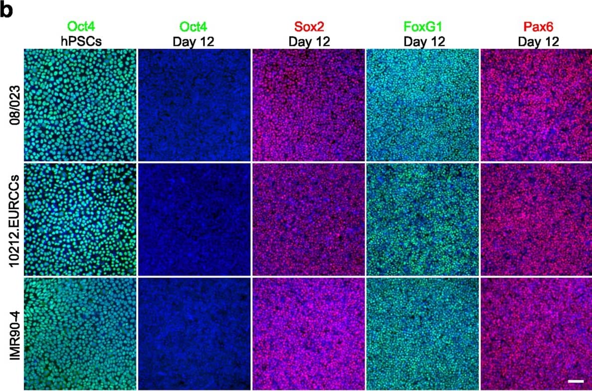 Detection of Human Oct-3/4 by Immunocytochemistry/Immunofluorescence
