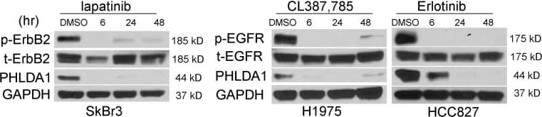 Detection of Human ErbB2/Her2 by Western Blot