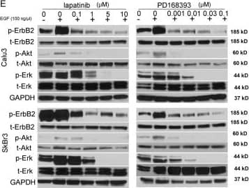 Detection of Human ErbB2/Her2 by Western Blot