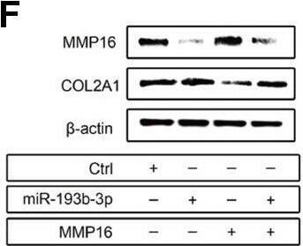 Detection of MMP-16/MT3-MMP by Western Blot