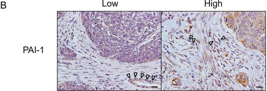Detection of Serpin E1/PAI-1 by Immunohistochemistry