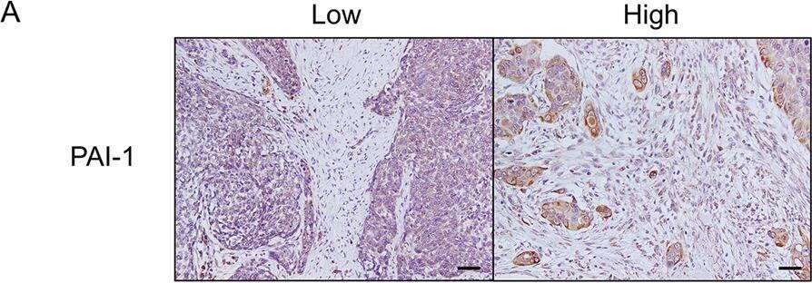 Detection of Serpin E1/PAI-1 by Immunohistochemistry