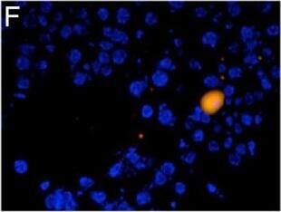 Detection of Mouse LIGHT/TNFSF14 by Immunocytochemistry/Immunofluorescence