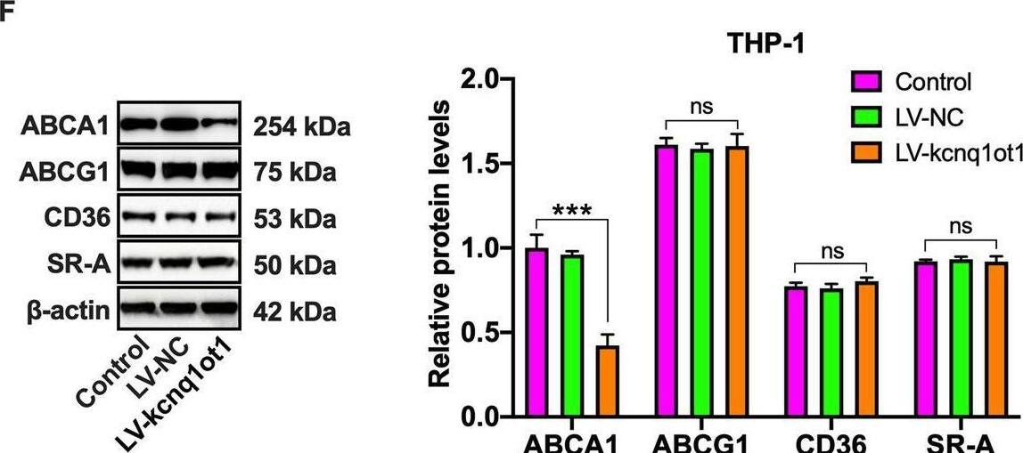 Detection of SR-AI/MSR by Western Blot