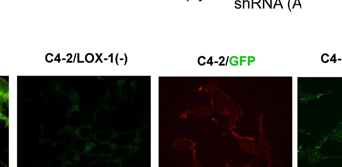 Detection of Human LOX-1/OLR1 by Western Blot