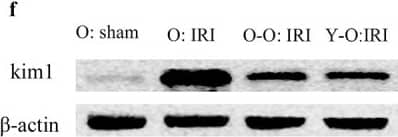Detection of Mouse TIM-1/KIM-1/HAVCR by Western Blot