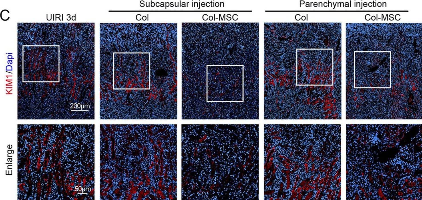 Detection of TIM-1/KIM-1/HAVCR by Immunohistochemistry