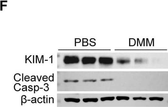 Detection of TIM-1/KIM-1/HAVCR by Western Blot