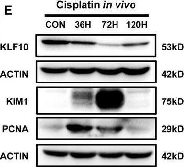 Detection of TIM-1/KIM-1/HAVCR by Western Blot