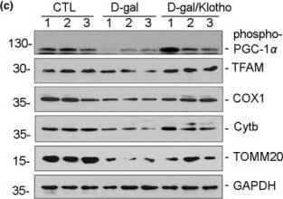 Detection of Human Klotho by Western Blot