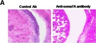 Detection of Mouse Semaphorin 7A by Immunohistochemistry