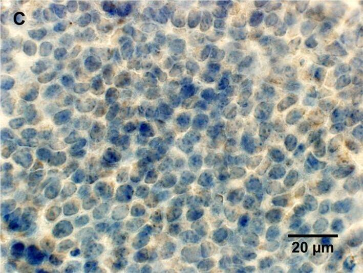 Detection of Mouse Lipocalin-2/NGAL by Immunocytochemistry/Immunofluorescence