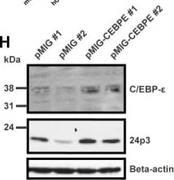 Detection of Mouse Lipocalin-2/NGAL by Western Blot