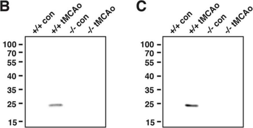 Detection of Mouse Lipocalin-2/NGAL by Western Blot