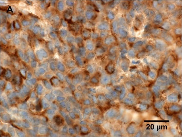Detection of Mouse Lipocalin-2/NGAL by Immunocytochemistry/Immunofluorescence