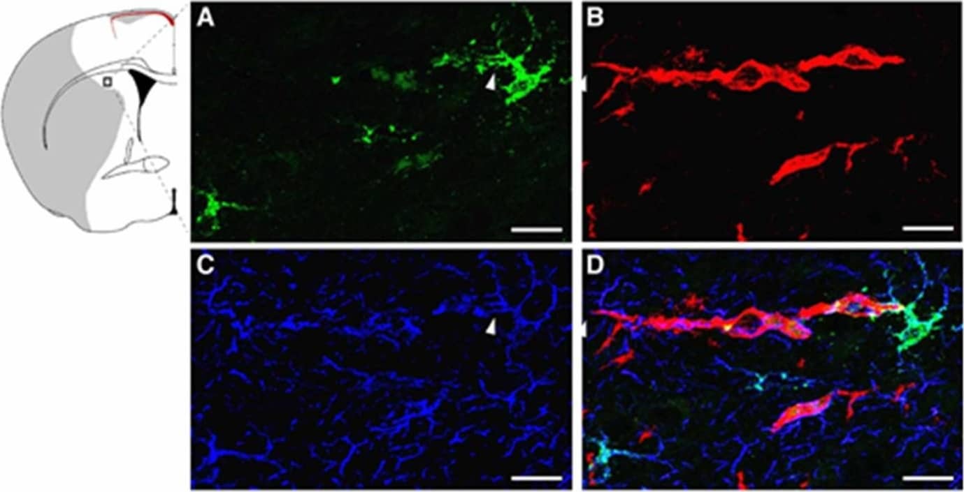 Detection of Mouse Lipocalin-2/NGAL by Immunocytochemistry/Immunofluorescence