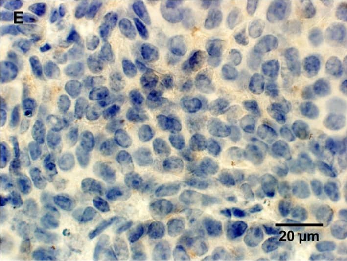 Detection of Mouse Lipocalin-2/NGAL by Immunocytochemistry/Immunofluorescence