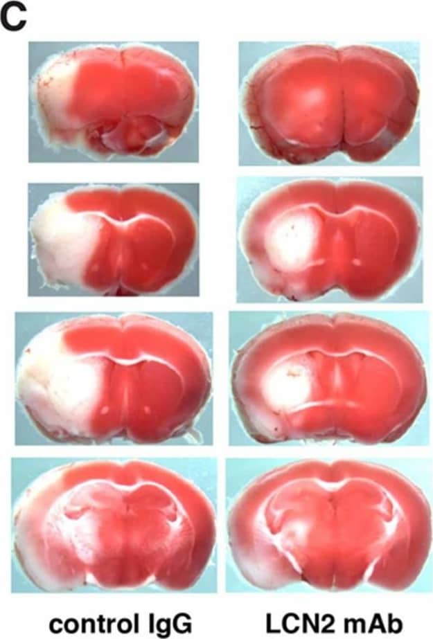 Detection of Mouse Lipocalin-2/NGAL by Immunocytochemistry/Immunofluorescence
