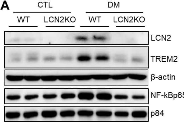 Detection of Lipocalin-2/NGAL by Western Blot