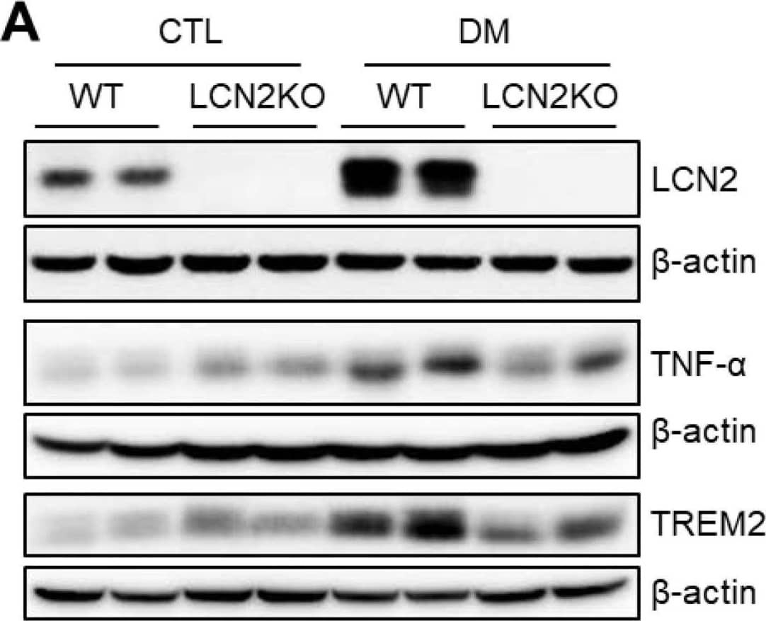 Detection of Lipocalin-2/NGAL by Western Blot