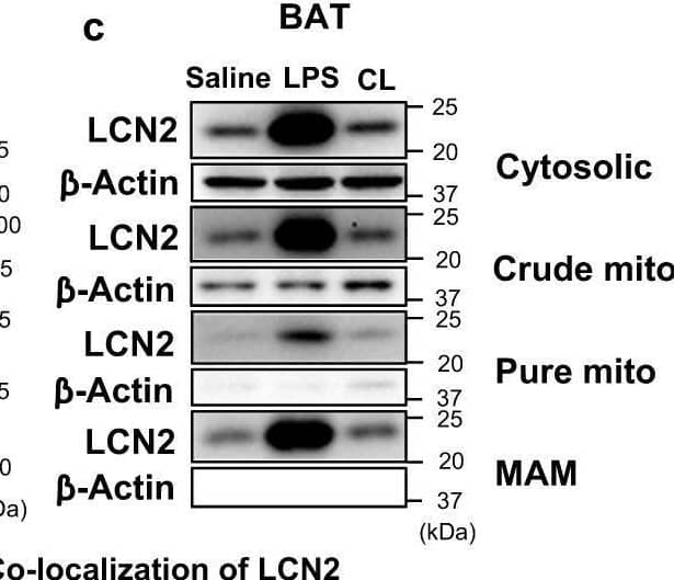Detection of Lipocalin-2/NGAL by Western Blot