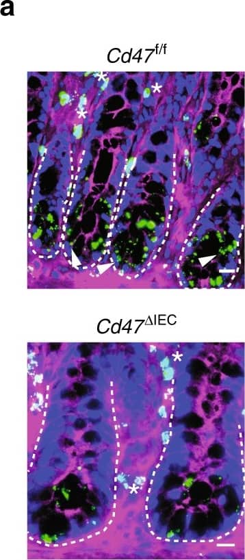 Detection of Mouse CD47 by Immunocytochemistry/Immunofluorescence