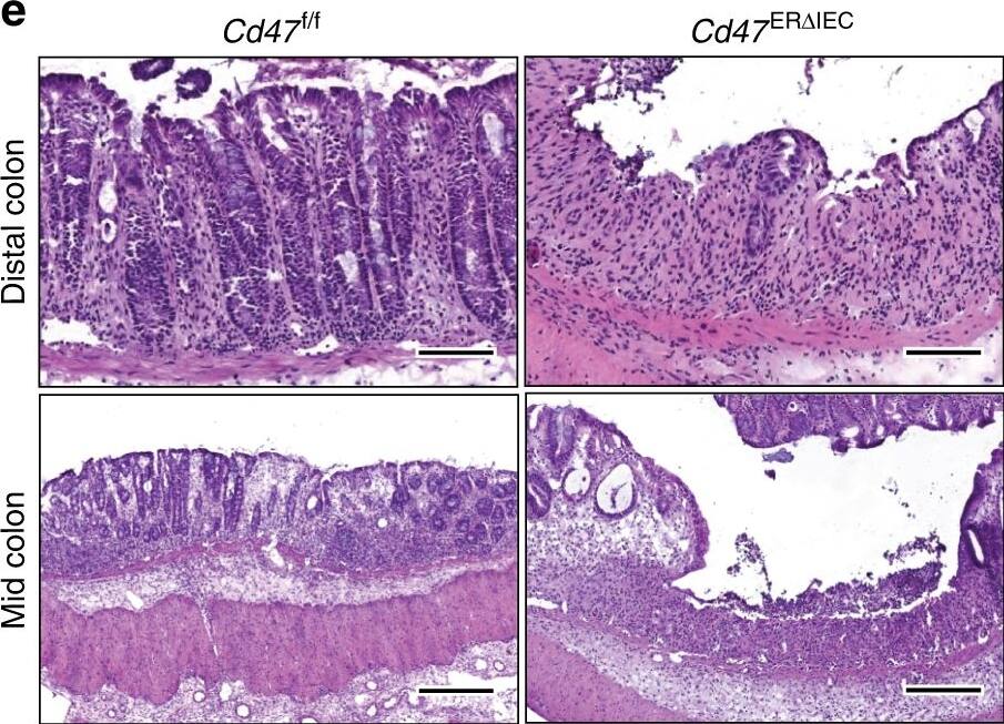 Detection of Mouse CD47 by Immunocytochemistry/Immunofluorescence
