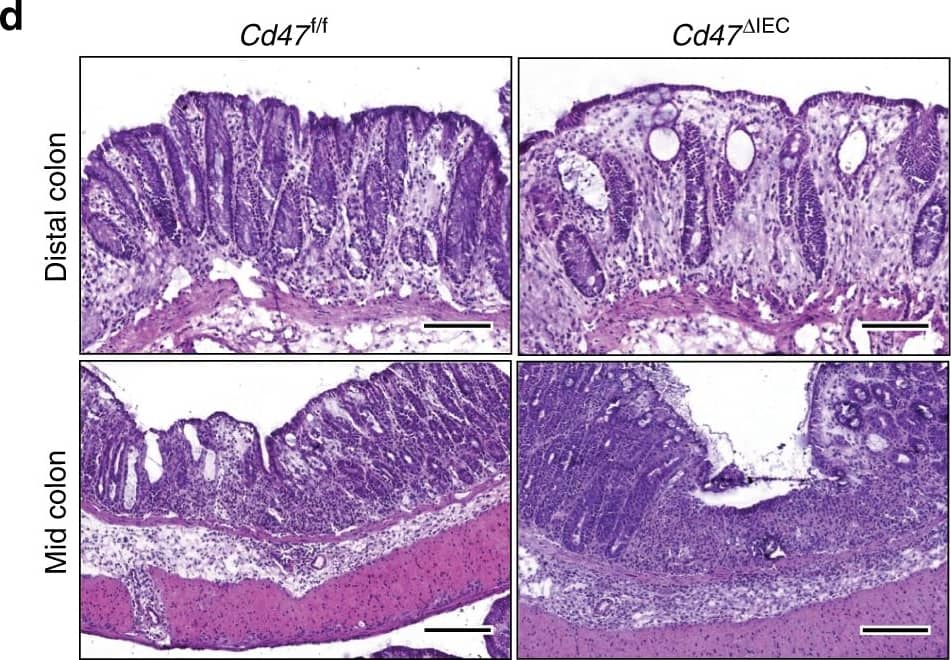 Detection of Mouse CD47 by Immunocytochemistry/Immunofluorescence