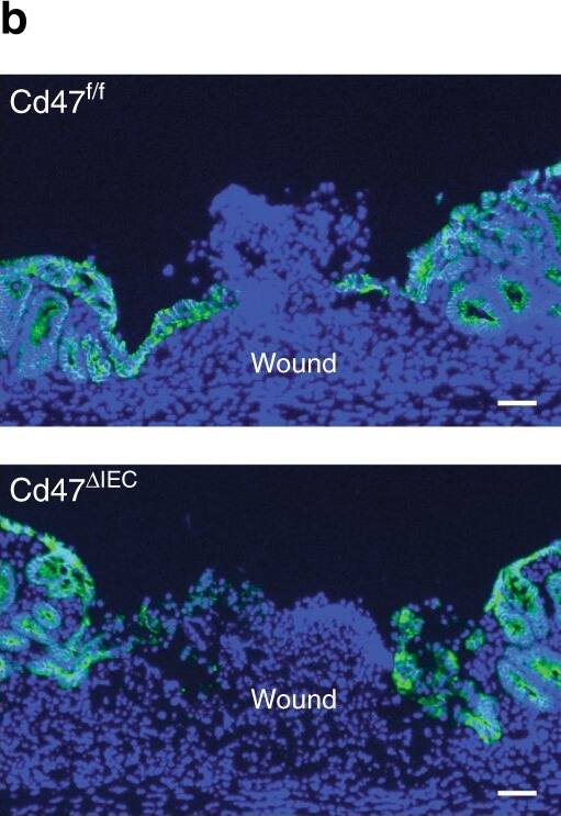 Detection of Mouse CD47 by Immunocytochemistry/Immunofluorescence