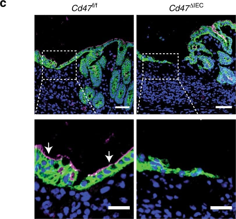 Detection of Mouse CD47 by Immunocytochemistry/Immunofluorescence
